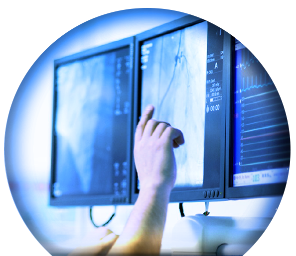 India Coronary Conquest 2025